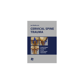 Cervical spine trauma