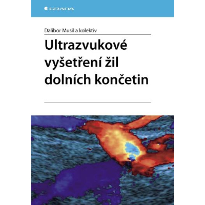 Ultrazvukové vyšetření žil dolních končetin