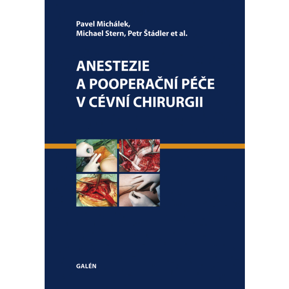 Anestezie a pooperační péče v cévní chirurgii                    